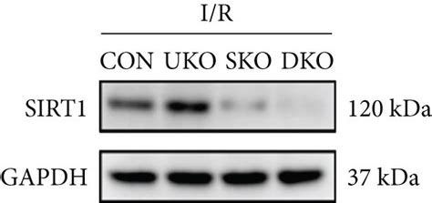 Usp Inhibition Protects Against Cerebral I R Injury Through Sirt In