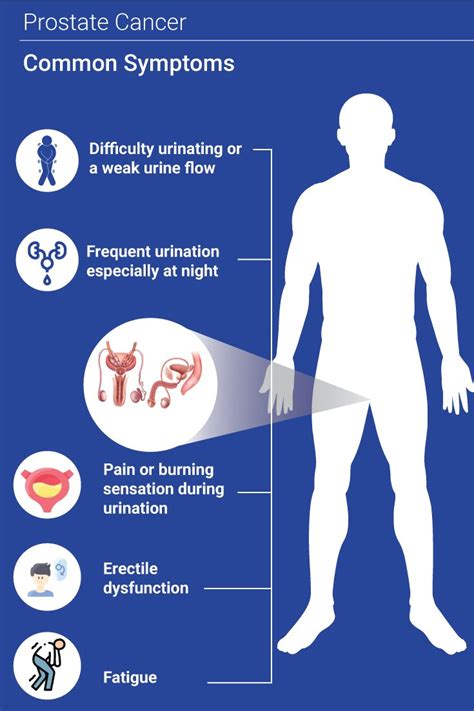 Prostate Cancer Causes Symptoms And Treatment