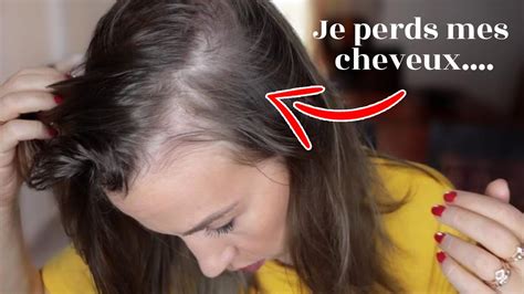 Chute De Cheveux Ma Solution Youtube