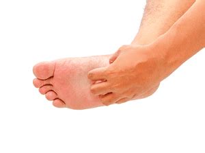 Itchy Bump On Sole Of Foot Online Emergencydentistry