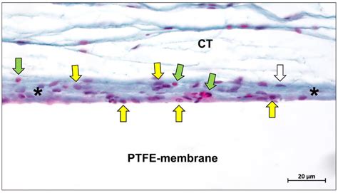 Ijms Free Full Text Barrier Membranes For Guided Bone Regeneration