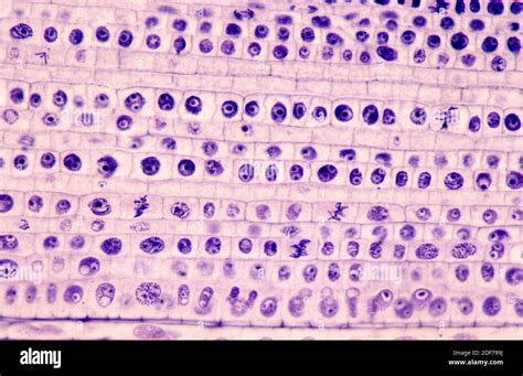 Mitosis Stages Under Microscope