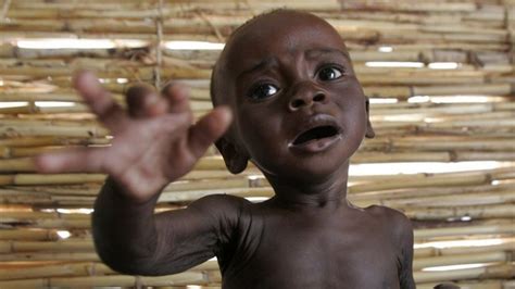 Niger Malnutrition Crisis Spreading Save The Children Bbc News