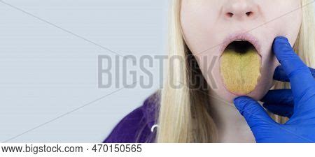 Woman Has Yellow Image & Photo (Free Trial) | Bigstock