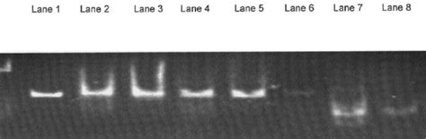 Pcr Sscp Analysis Using A Pair Of Primers Spanning The Entire Sry Gene