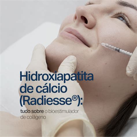 Hidroxiapatita de cálcio Radiesse tudo sobre o bioestimulador de