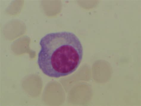 Plasma Cell Plasmocyte Image Medicalchemy Immunology