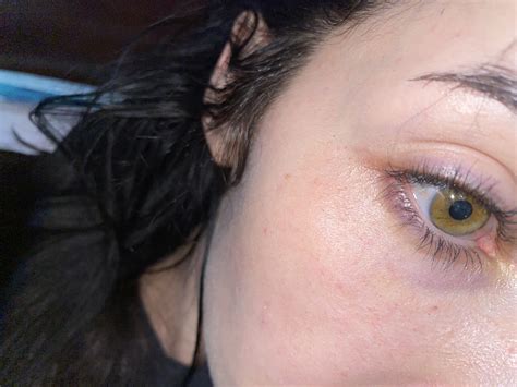 FROWNIES. Details in comments : r/30PlusSkinCare