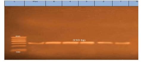 Agrose Gel Electrophoresis Of PCR Amplified Products Of Virulence