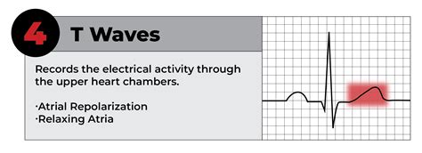 How To Read An Ekg Strip In 5 Steps Cardiacdirect