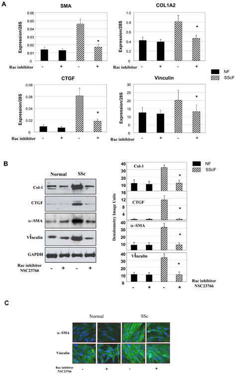 Rac Inhibition Suppresses The Pro Fibrotic Phenotype Of Lesional Ssc