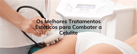 Os Melhores Tratamentos Estéticos para Combater a Celulite Clinica