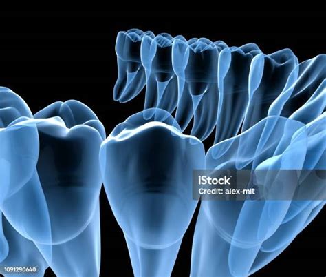 Dental Anatomy Of Mandibular Human Gum And Teeth Xray View Medically