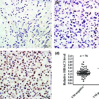 Relationship Between Vasculogenic Mimicry Vm And Clinicopathological