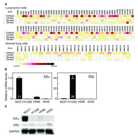 | Gene expression in human lung tumor and normal bronchial epithelial ... 