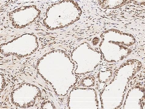 CtBP1 Polyclonal Antibody Invitrogen 100 μL Unconjugated Antibodies