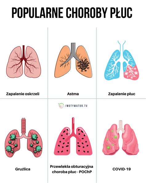 Przewlek A Obturacyjna Choroba P Uc Pochp Motywator Tv