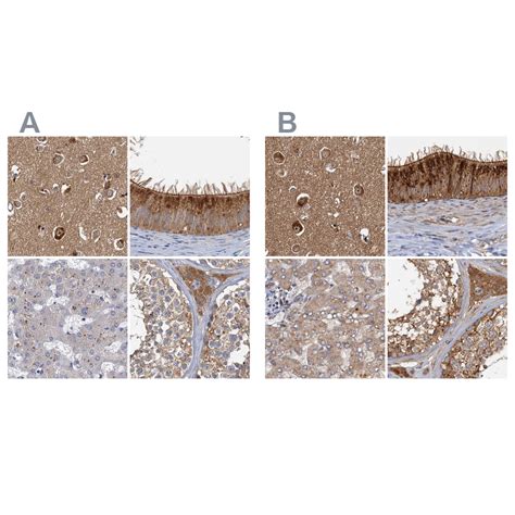 Rabbit Polyclonal Anti Tollip Antibody Buy For Research Highly Specific Rigorously