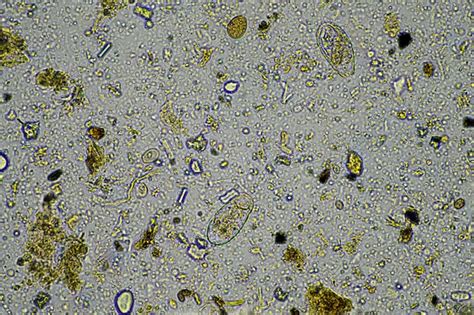 Premium Photo | Microscopic fungus and microorganisms in a sample in ...