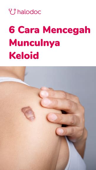 Dokter Spesialis Kulit Keloid