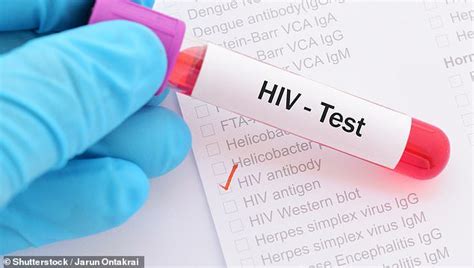 Scientists Succeed In Destroying Hiv Infected Cell In Breakthrough