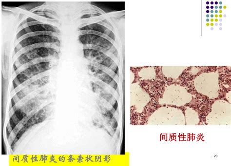 内科学2 呼吸系统疾病（更新中） 知乎