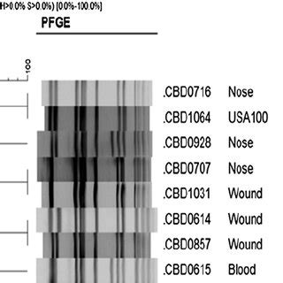 Variation In Pulsed Field Patterns Of Usa Mrsa N Number Of