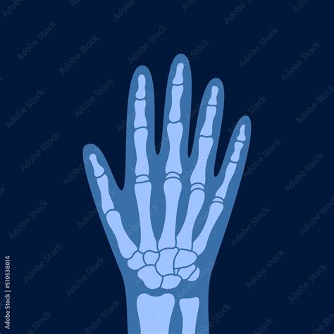 X-ray of human hand bones. Human joint anatomy x-rays vector ...