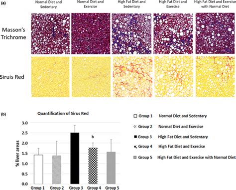 A Sirius Red And Masson S Trichrome Staining Of Liver And B Download Scientific Diagram