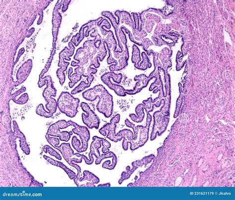 Fallopian Tube. Ciliated Epithelium Royalty-Free Stock Image ...