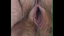 Hairy Upskirt Videos XVIDEOS