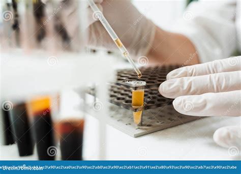 Analysis Of Blood Plasma Close Up Laboratory Assistant Hold Test Tube