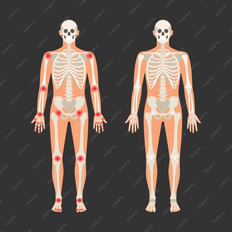 Premium Vector | Human skeleton with pain points in rheumatoid
