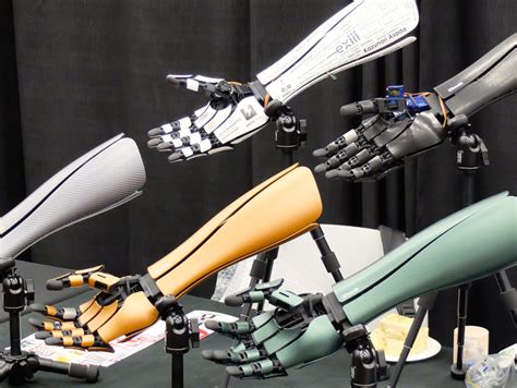 This robotic arm is part prosthetic, part fashion statement