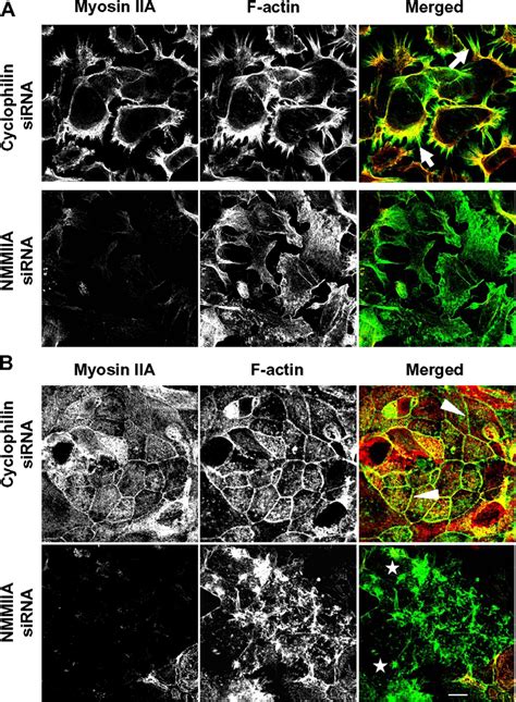 Sirna Knock Down Of Nmmiia Causes Disorganization Of F Actin