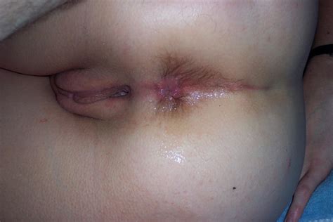 Unwashed Dirty Asshole Porn Pictures Xxx Photos Sex Images Pictoa