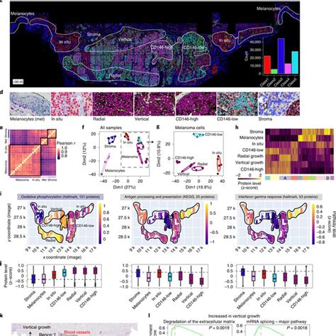 Dvp Applied To Archived Primary Melanoma Tissue A Dvp Sample Isolation