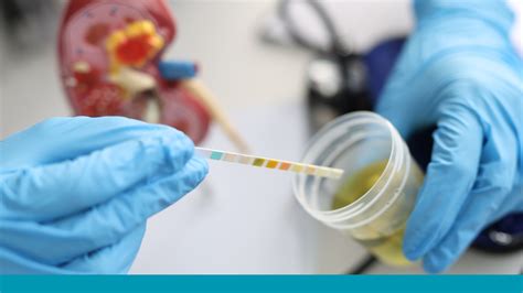 how to know if you have ketones in urine