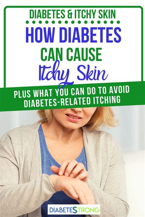 Diabetes And Itching Causes And Treatment Options Artofit