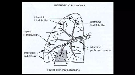 Patologia De Torax Radiologica Ppt