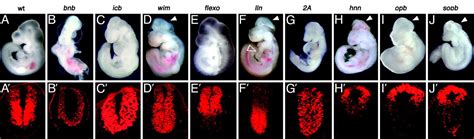 Analysis Of Mouse Embryonic Patterning And Morphogenesis By Forward