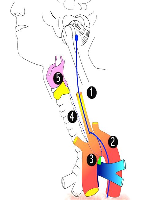 Recurrent Laryngeal Nerve