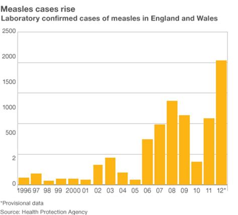 Measles Outbreak Uk 2024 - Eleen Harriot