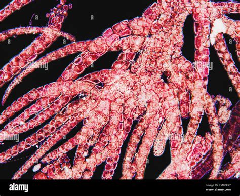 Red Algae Under Microscopic View Dark Background Stock Photo Alamy