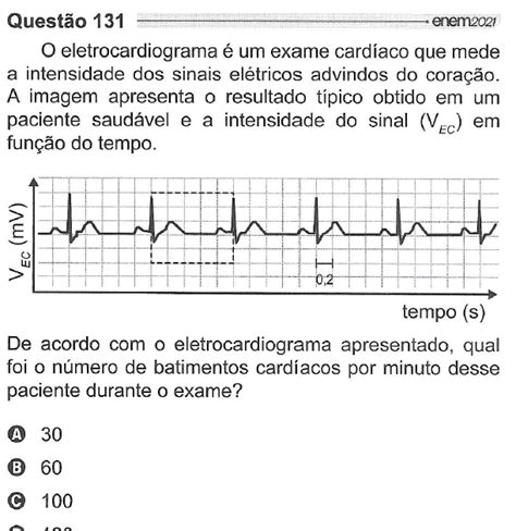 Enem O Eletrocardiograma Um Exame Card Aco Que Mede A