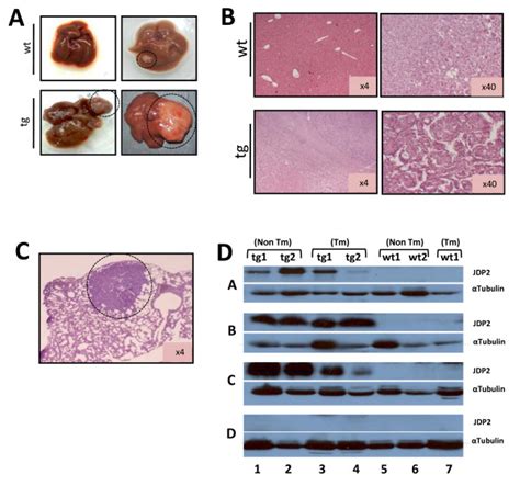 Liver Tumors Analysis For 14 Days Den Protocol A Representative Liver Download Scientific