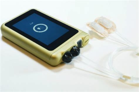 The iLet Bionic Pancreas Could Change Diabetes Treatment