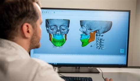 Mund Kiefer Und Gesichtschirurgie