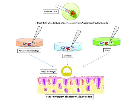 Application of cultomised embryo culture media | Download Scientific ...