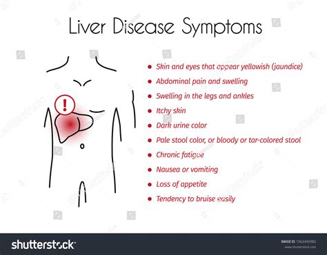 Liver Disease Symptoms Infographic Vector Linear Stock Vector (Royalty ...